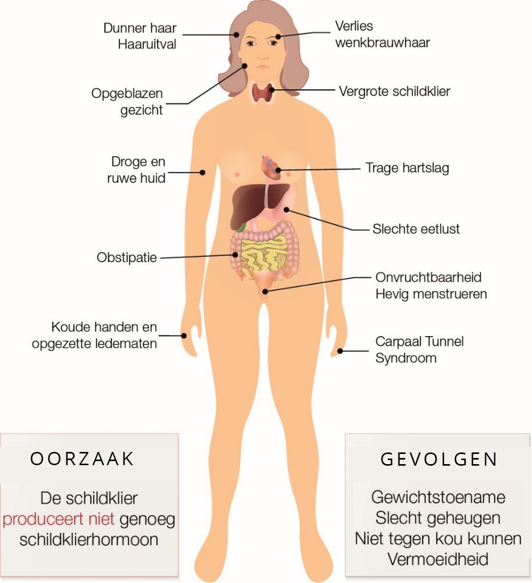 Symptomen slecht werkende schildklier